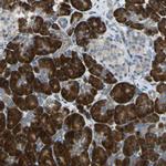 SELS Antibody in Immunohistochemistry (Paraffin) (IHC (P))