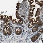 SELS Antibody in Immunohistochemistry (Paraffin) (IHC (P))