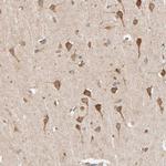 TIM17 Antibody in Immunohistochemistry (Paraffin) (IHC (P))