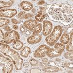 TIM17 Antibody in Immunohistochemistry (Paraffin) (IHC (P))