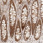 TIM17 Antibody in Immunohistochemistry (IHC)