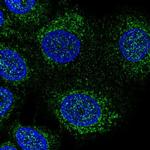 DHODH Antibody in Immunocytochemistry (ICC/IF)