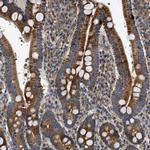 DHODH Antibody in Immunohistochemistry (Paraffin) (IHC (P))