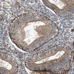 DHODH Antibody in Immunohistochemistry (Paraffin) (IHC (P))