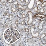 DHODH Antibody in Immunohistochemistry (IHC)