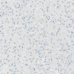 UPK3B Antibody in Immunohistochemistry (Paraffin) (IHC (P))