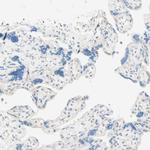 UPK3B Antibody in Immunohistochemistry (Paraffin) (IHC (P))