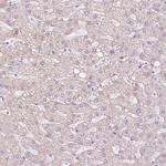 CLPS Antibody in Immunohistochemistry (Paraffin) (IHC (P))