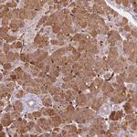 CLPS Antibody in Immunohistochemistry (Paraffin) (IHC (P))