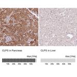 CLPS Antibody in Immunohistochemistry (IHC)