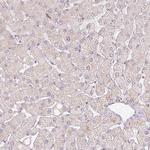 CLPS Antibody in Immunohistochemistry (IHC)