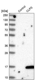 CLPS Antibody in Western Blot (WB)