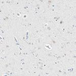 IkB zeta Antibody in Immunohistochemistry (Paraffin) (IHC (P))