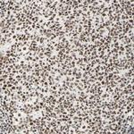 WTAP Antibody in Immunohistochemistry (IHC)