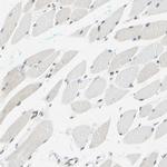 WTAP Antibody in Immunohistochemistry (IHC)