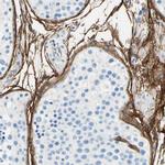 MFAP5 Antibody in Immunohistochemistry (Paraffin) (IHC (P))