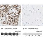 MFAP5 Antibody in Immunohistochemistry (IHC)