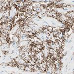 MFAP5 Antibody in Immunohistochemistry (IHC)