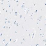 MFAP5 Antibody in Immunohistochemistry (IHC)