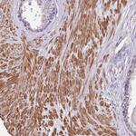 Synaptotagmin 4 Antibody in Immunohistochemistry (Paraffin) (IHC (P))