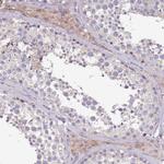 Synaptotagmin 4 Antibody in Immunohistochemistry (Paraffin) (IHC (P))