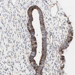 AGPAT5 Antibody in Immunohistochemistry (Paraffin) (IHC (P))