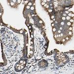 CLPP Antibody in Immunohistochemistry (IHC)