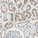 CLPP Antibody in Immunohistochemistry (IHC)