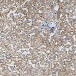 CLPP Antibody in Immunohistochemistry (IHC)