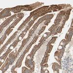 MTM1 Antibody in Immunohistochemistry (IHC)