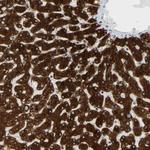 MGST2 Antibody in Immunohistochemistry (Paraffin) (IHC (P))