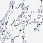 ABHD3 Antibody in Immunohistochemistry (Paraffin) (IHC (P))