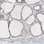 LRIG3 Antibody in Immunohistochemistry (IHC)