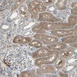 IGSF9B Antibody in Immunohistochemistry (Paraffin) (IHC (P))