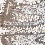 IGSF9B Antibody in Immunohistochemistry (Paraffin) (IHC (P))