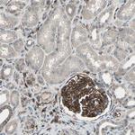 Dysadherin Antibody in Immunohistochemistry (Paraffin) (IHC (P))