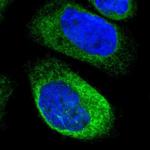 Dysadherin Antibody in Immunocytochemistry (ICC/IF)