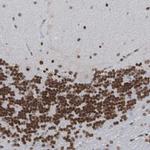 PHF2 Antibody in Immunohistochemistry (Paraffin) (IHC (P))