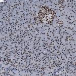 PHF2 Antibody in Immunohistochemistry (Paraffin) (IHC (P))