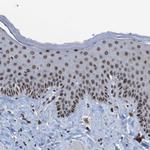 PHF2 Antibody in Immunohistochemistry (Paraffin) (IHC (P))