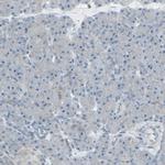 FXYD3 Antibody in Immunohistochemistry (IHC)