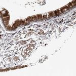 BAMBI Antibody in Immunohistochemistry (Paraffin) (IHC (P))