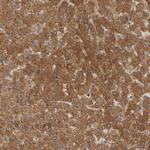 ALDH9A1 Antibody in Immunohistochemistry (Paraffin) (IHC (P))