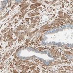 DPYSL3 Antibody in Immunohistochemistry (Paraffin) (IHC (P))