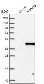 AGPAT5 Antibody in Western Blot (WB)