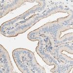 Stomatin Antibody in Immunohistochemistry (IHC)