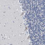 VMA21 Antibody in Immunohistochemistry (Paraffin) (IHC (P))