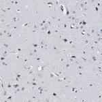 VMA21 Antibody in Immunohistochemistry (Paraffin) (IHC (P))