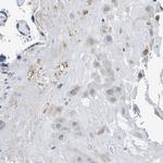 VMA21 Antibody in Immunohistochemistry (Paraffin) (IHC (P))