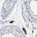 VMA21 Antibody in Immunohistochemistry (Paraffin) (IHC (P))